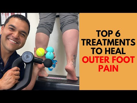 Видео: 6 лучших надежных методов лечения боли в наружной части стопы при синдроме кубовидной кости