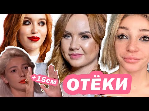 Видео: Как убрать ОТЁК? почему он ФОРМИРУЕТСЯ? ЛИМФОДРЕНАЖНАЯ СИСТЕМА и 10000 шагов