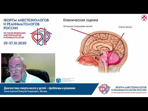 Видео: Диагностика смерти мозга у детей Амчеславский В.Г.