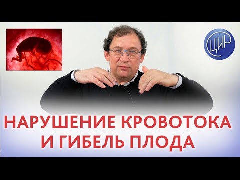 Видео: Кровоток плода. НАРУШЕНИЕ КРОВОТОКА и внутриутробная гибель плода. Как НЕ ДОПУСТИТЬ ПОВТОРЕНИЯ ?