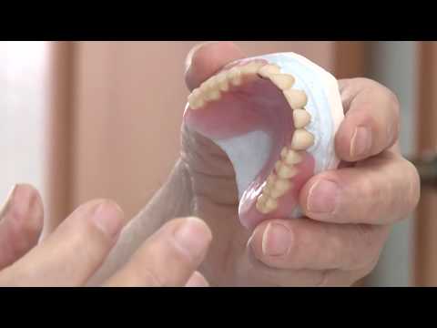 Видео: Кламмерная система Куретовых