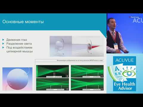 Видео: Пресбиопия. Коррекция пресбиопии контактными линзами.