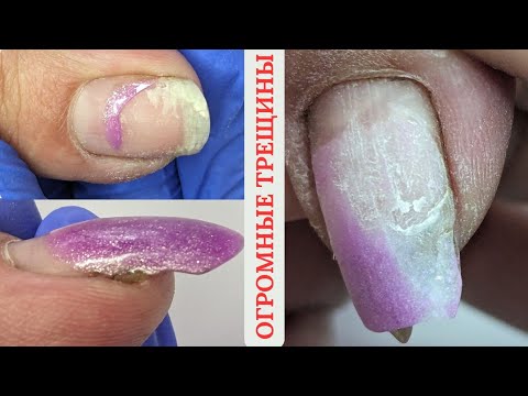 Видео: ОГРОМНЫЕ ТРЕЩИНЫ // РОЖАВШАЯ ЖЕНЩИНА // ВСЕГДА СЛОЖНАЯ КОРРЕКЦИЯ