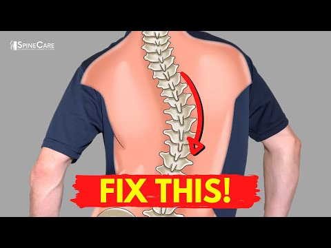 Видео: Как облегчить боль в спине при сколиозе за 30 секунд
