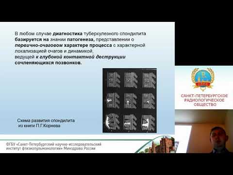 Видео: Баулин И.А. Семиотика и дифференциальная диагностика туберкулезного спондилита