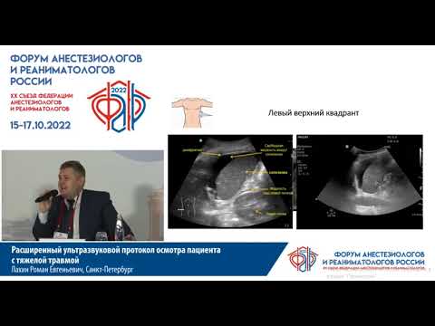 Видео: УЗИ протокол при травме Лахин Р.Е.