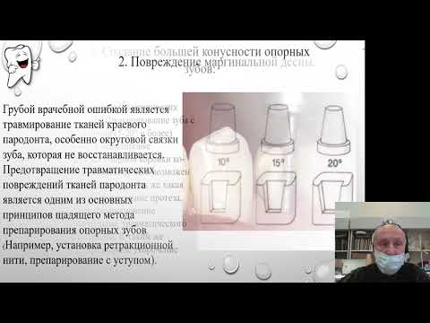 Видео: Простое протезирование 3. Ошибки и осложнения при лечении мостовидными протезами