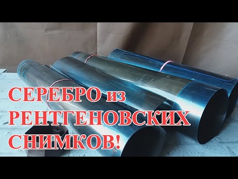 Видео: СЕРЕБРО ИЗ РЕНТГЕНОВСКИХ СНИМКОВ 1кг!