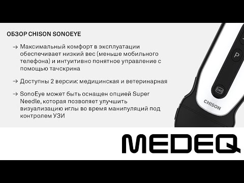 Видео: Портативный аппарат УЗИ Chison Sonotouch 30 (SonoEye) | Обзор от MEDEQ