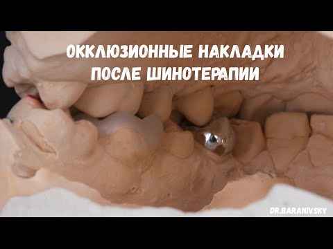 Видео: Окклюзионные накладки после шинотерапии