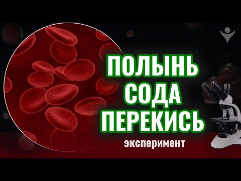 Видео: Полынь, сода, перекись. Эксперимент | Навигатор здоровья