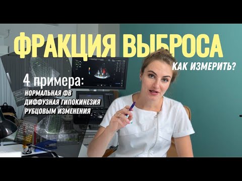 Видео: Как измерить ФРАКЦИЮ ВЫБРОСА? Полный урок! Измеряем ФВ в НОРМЕ, при диффузной гипокинезии, и РУБЦАХ