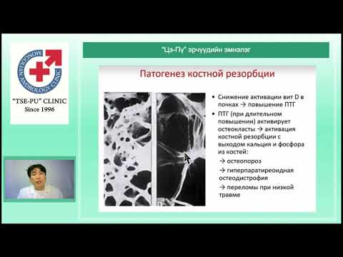 Видео: Д витамин ба бөөрний чулуу