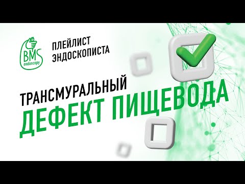Видео: 🟢Трансмуральный дефект пищевода и эндоскопическая вакуумная терапия #playlistэндоскописта