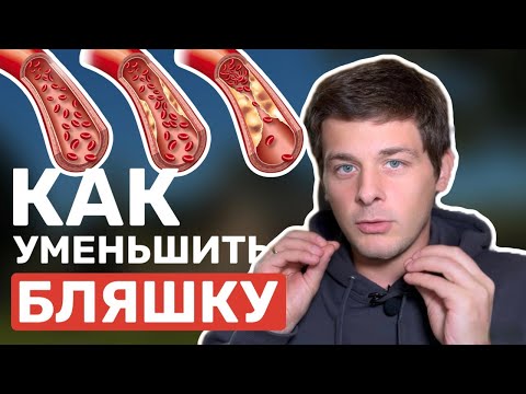 Видео: Как уменьшить атеросклеротическую бляшку