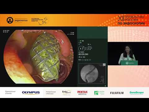 Видео: Раз уж мы делаем ошибки, надо делать их красиво