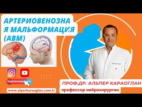 Видео: Что такое артериовенозная мальформация (АВМ)? | Проф. Др. Альпер КАРАОГЛАН
