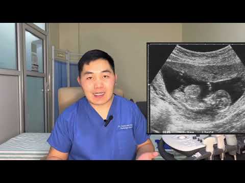 Видео: 8 долоо хоногтой жирэмсэн ээжүүд анхааралтай үзээрэй 🤰🫄