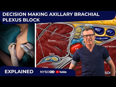 Видео: Объяснение принятия решения о подмышечной анестезии — экспресс-курс с доктором Хаджичем