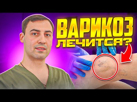 Видео: Эффективные методы лечения и профилактики варикозного расширения вен