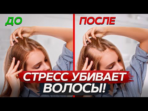 Видео: СТРЕСС СДЕЛАЕТ ТЕБЯ ЛЫСЫМ! / Как предотвратить выпадение волос?