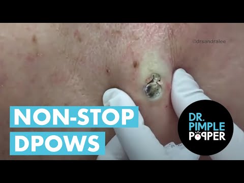 Видео: DPOWS, который изменил химию моего мозга!