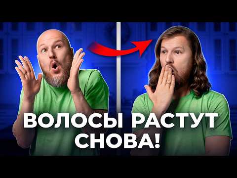 Видео: Как включить рост волос? Облысение больше не страшно