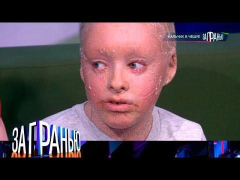 Видео: За гранью. Выпуск от 20.10.2025 - «Мальчик в чешуе» Передачи НТВ