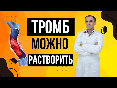 Видео: Обнаружили тромб в 24 года. Как жить с этим? Флеболог Москва.