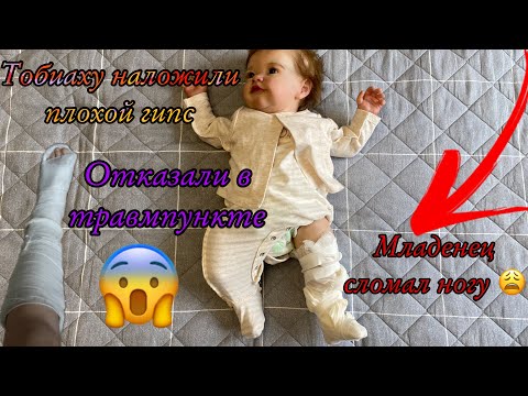 Видео: ТОБИАХ СЛОМАЛ НОГУ У МЕНЯ ИСТЕРИКА НАЛОЖИЛИ ПЛОХОЙ ГИПС МЛАДЕНЦУ РЕБОРНУ ОТКАЗАЛИ В ТРАВМПУНКТЕ