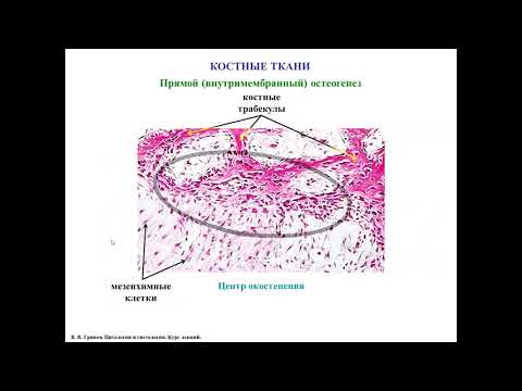 Видео: Остеогенез - развитие костных тканей