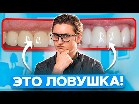 Видео: МЕТАЛЛОКЕРАМИКА или ЦИРКОНИЙ? Какие коронки выбрать в 2025 году?