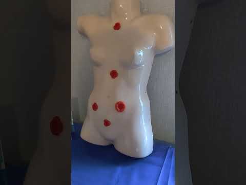 Видео: Как быстро заменить калоприемник или уроприемник?