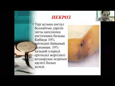 Видео: Инъекциядан кейінгі болатын асқынулар.