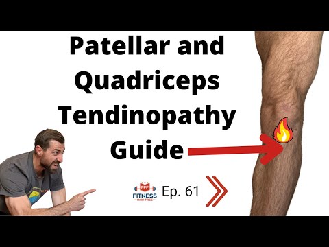 Видео: Тендинопатия надколенника и четырёхглавой мышцы: руководство, основанное на фактических данных — ...