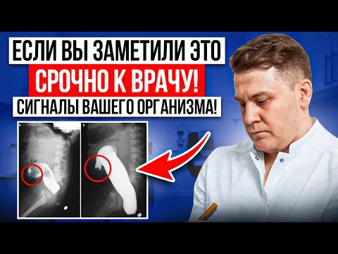 Видео: ТРЕВОЖНЫЕ СИГНАЛЫ МОЧЕВОГО ПУЗЫРЯ КОТОРЫЕ НЕЛЬЗЯ ИГНОРИРОВАТЬСЯ
