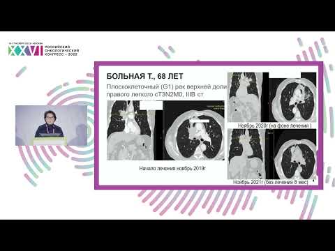 Видео: Отсроченная токсичность иммунотерапии. Как лечить?