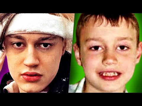 Видео: НЕКОГЛАЙ — До Того Как Стал Известен!