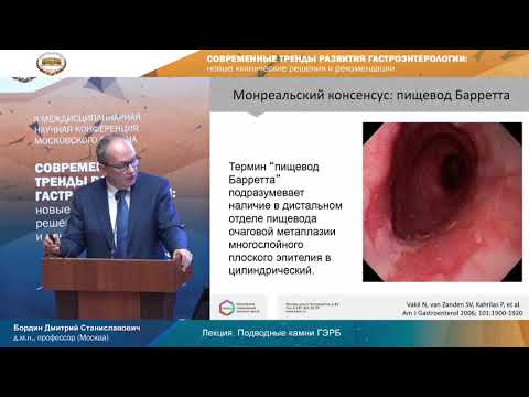 Видео: Бордин Д.С. Подводные камни ГЭРБ