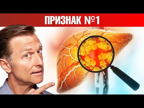 Видео: Симптом №1 того, что у вас жирная печень🙌