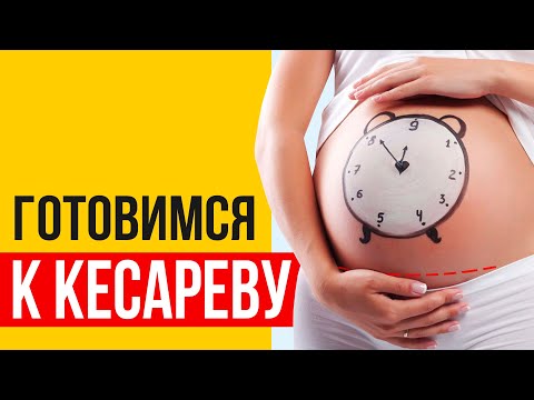 Видео: Подготовка к кесареву сечению. Важные правила для будущей мамы.