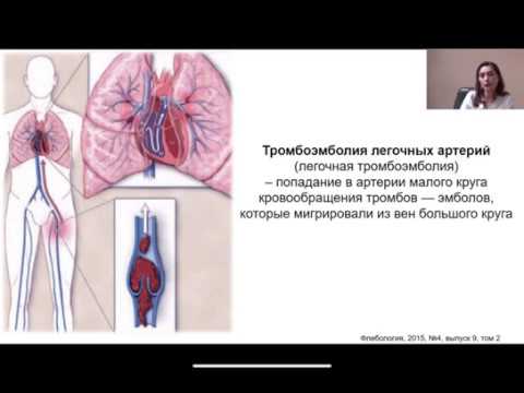Видео: Тромбопрофилактика в акушерстве. Рекомендации по диагностике и лечению ТЭЛА 2019 (ESC+ESR)
