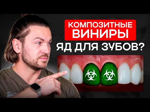 Видео: Композитные ВИНИРЫ — почему это ОПАСНО? / Ошибка в выборе виниров и серьезные последствия