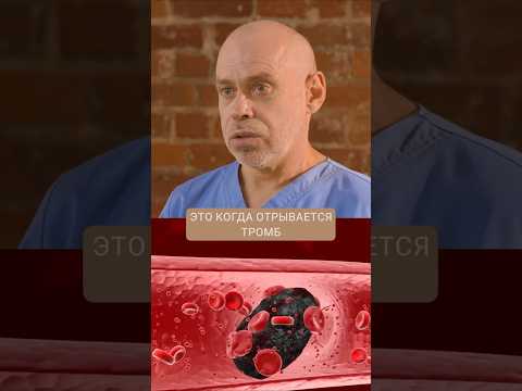Видео: Последствия ЭТОГО необратимы! Сделайте 1 СХЕМУ для улучшения кровотока #жаншоломицкий