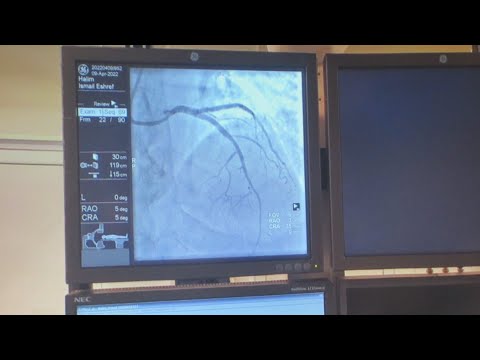 Видео: Русе ползва технология №1 в света за лечение на съдови стеснения на сърцето