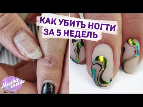 Видео: Боевая клиентка :) Преображение ногтей: СОДРАННЫЙ гель лак, укрепление ногтей. Простой маникюр