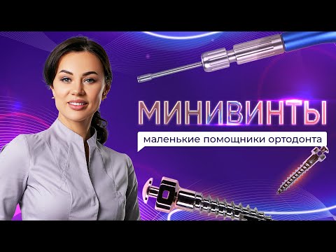 Видео: Минивинты - Зачем их устанавливают, плюсы и минусы. Кто решает устанавливать минивинты?