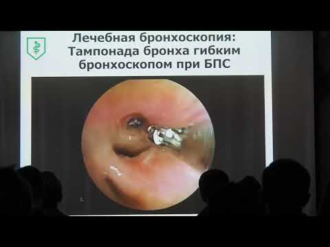 Видео: 01 Коржева ИЮ Лечебная бронхоскопия в практике эндоскописта