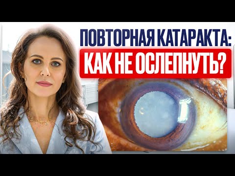 Видео: Что ВАЖНО знать о повторной замене хрусталика? ВСЁ о вторичной катаракте от профессора Шиловой!