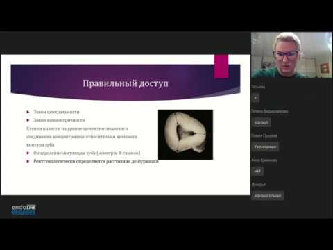 Видео: Endo.Education Вебинар Надежды Звягинцевой "Время-эффективность в эндодонтии"